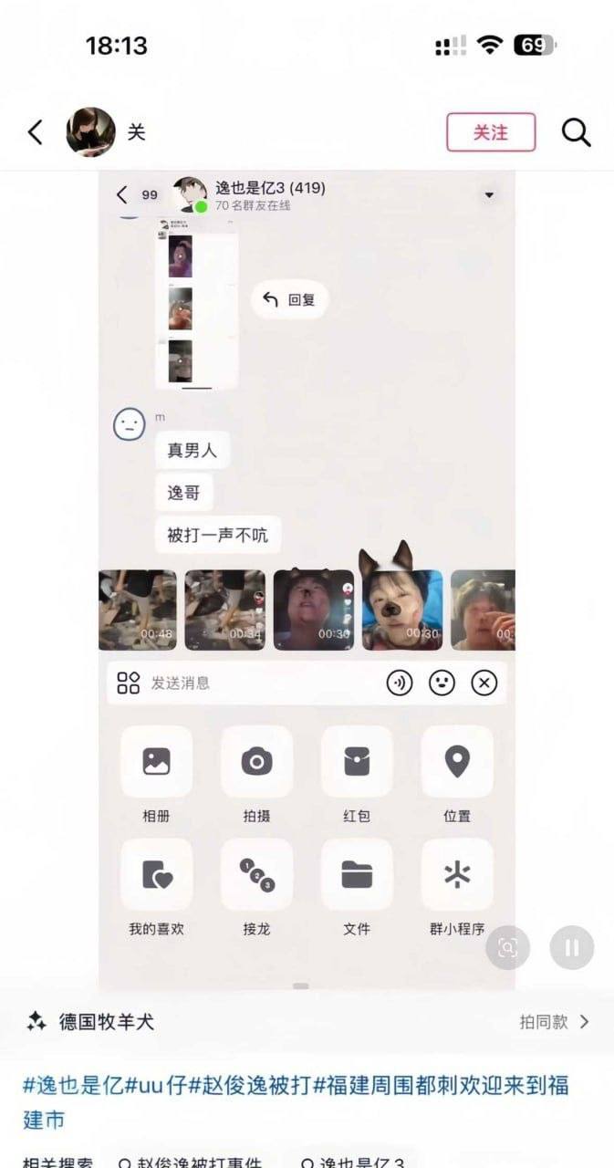 深圳小网红赵俊逸疑似遭围殴事件目前仍缺官方或本人证实，现场视频显示其头部、面部受伤，场面混乱 - 图片