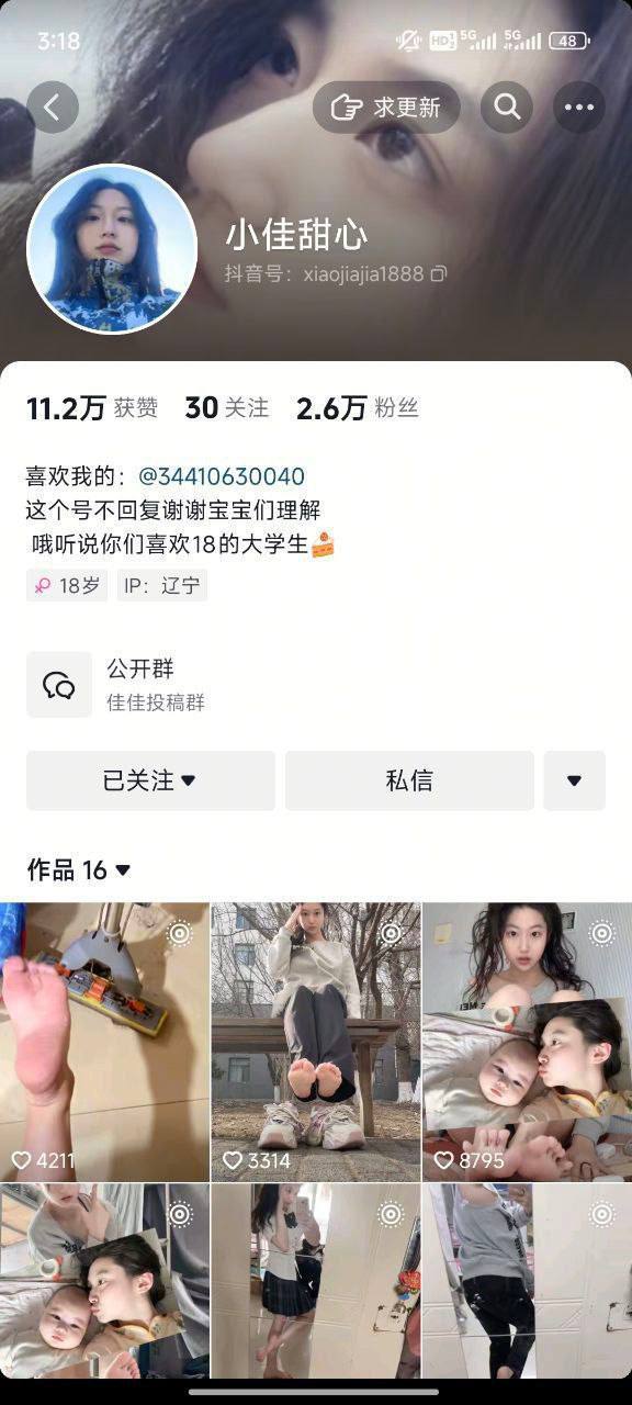 #小佳甜心 辽宁省锦州市目前是某技校在校大三大学生 因其清纯甜美的颜值及性感的身材在抖音也算一名小网红 线下及其反差妥妥的母狗一枚 - 图片