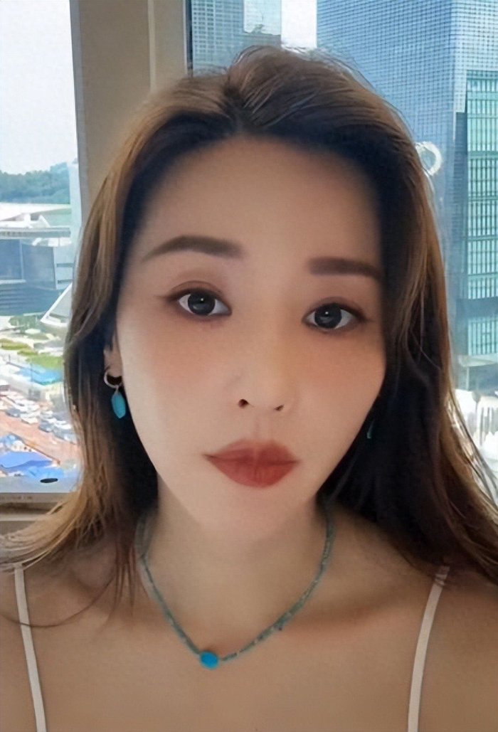 吴佳尼曝有演员打完肉毒没法拍戏