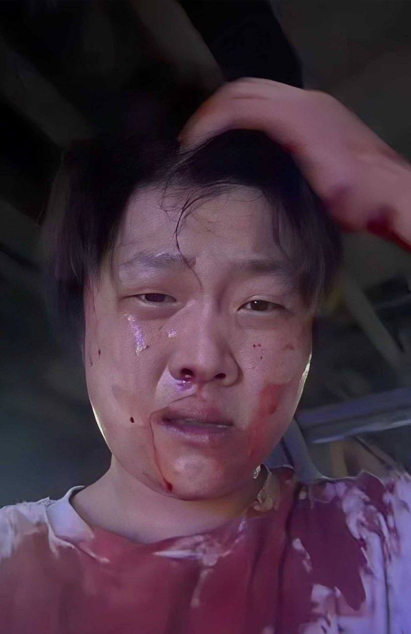 深圳小网红赵俊逸疑似遭围殴事件目前仍缺官方或本人证实，现场视频显示其头部、面部受伤，场面混乱 - 图片