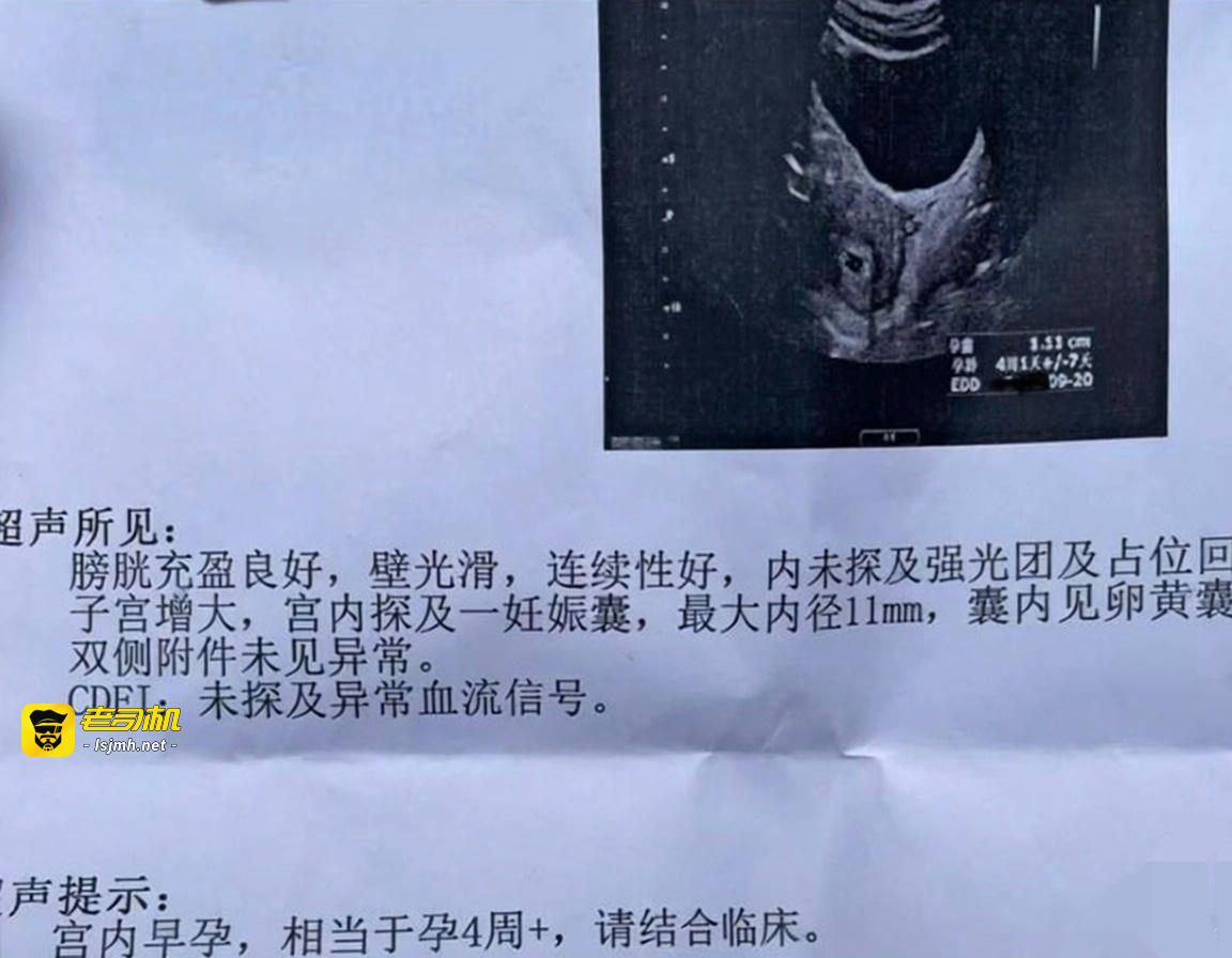 知名演员 李沁 被爆私生活混乱！陪睡导演与杨洋邓伦雷军等人有染 多次堕胎每睡一次10万补偿 震撼全网！ - 图片