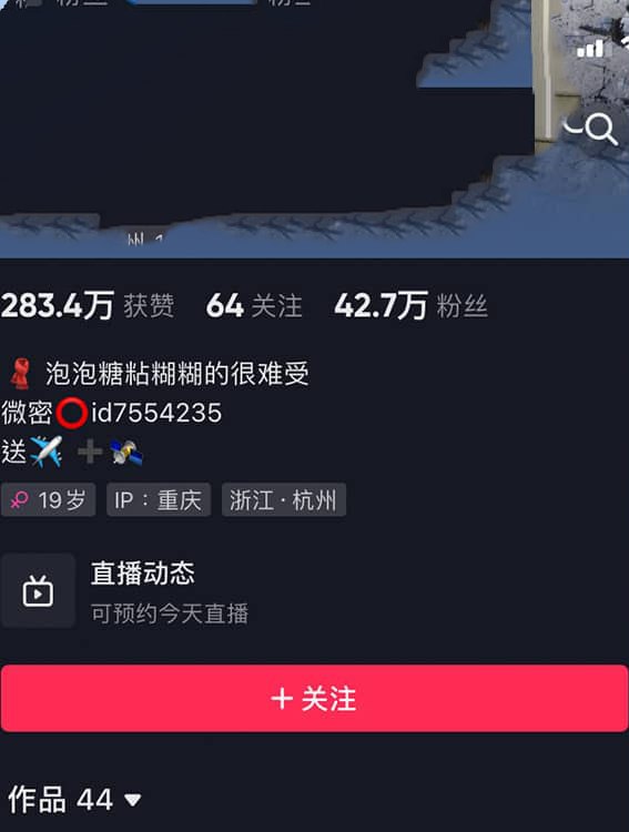 #微密圈 #琳铛 NO.008