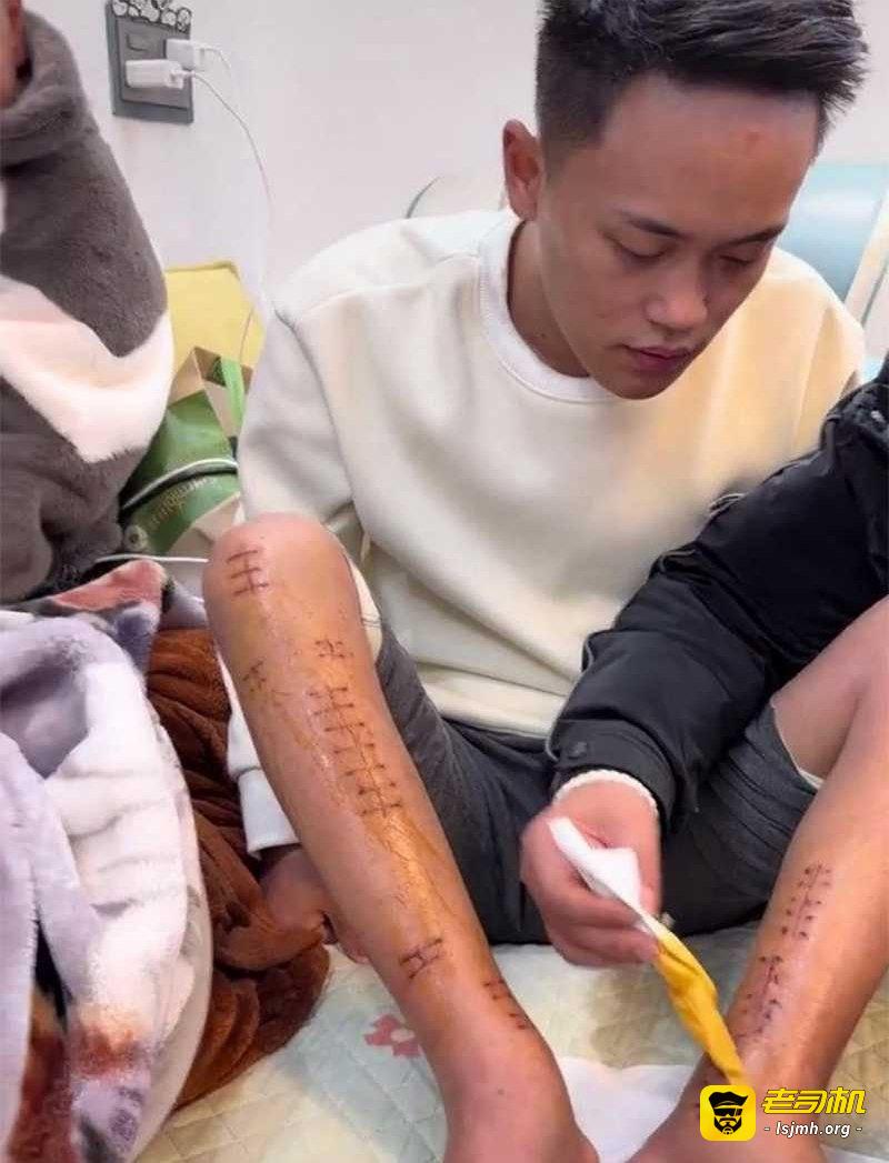 蓝战非事件再现！知名网红 非洲洋洋 诱骗博主曾凡贵网诈国人 反抗竟遭虐待打断双腿！ - 图片