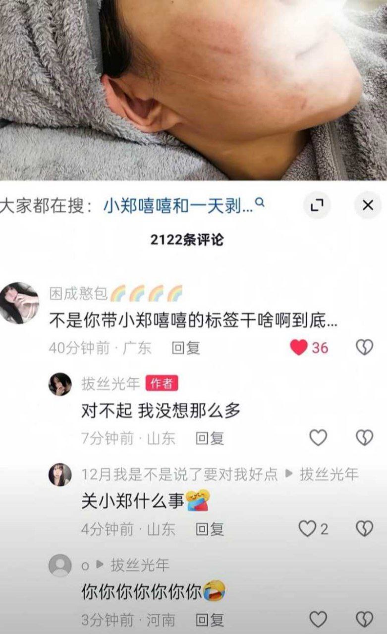 抖音网红一天出婚内轨拔丝光年让其怀孕 老婆小郑嘻嘻也出轨并反咬一口舆论引导网爆 - 图片